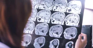 Egy új mobilapp korábbi stádiumban fedezheti fel a demenciát, mint bármelyik orvosi eszköz 